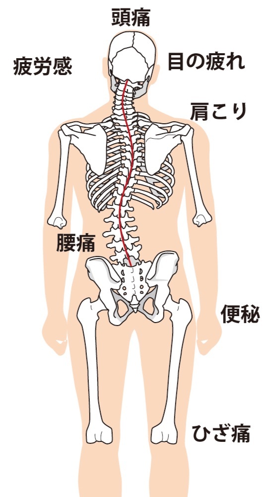 骨格のゆがみ